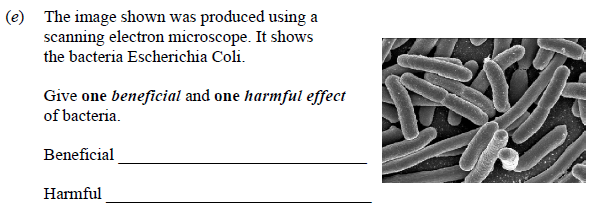 The-image-shown-was-produced-using-a-scanning-electron-microscope-Junior Cycle Science-Question e-2010.png