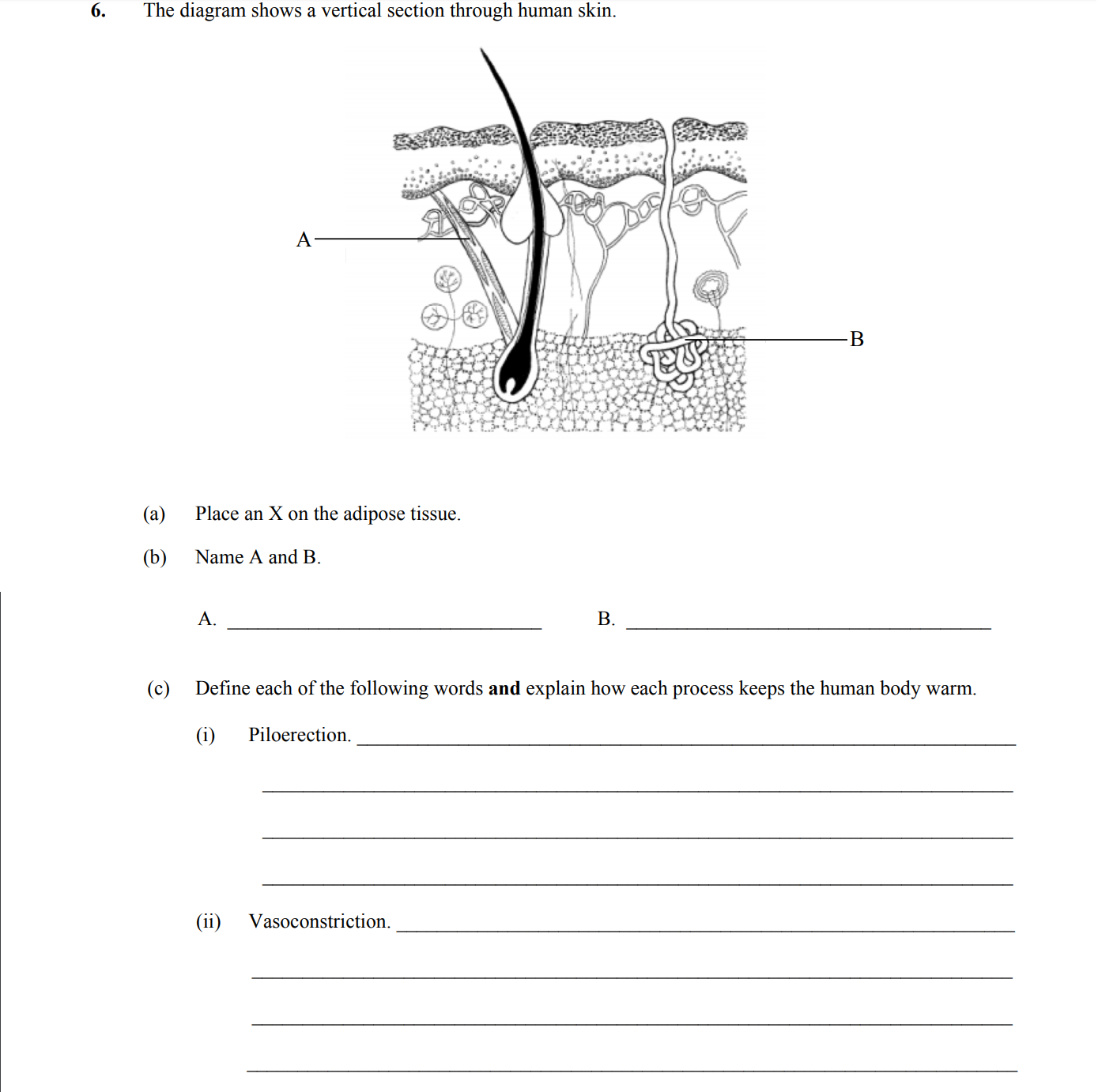The-diagram-shows-a-vertical-section-through-human-skin-Leaving Cert Biology-Question 6-2015.png
