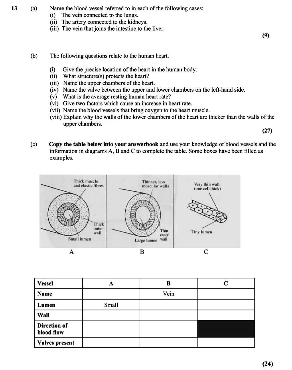 Name-the-blood-vessel-referred-to-in-each-of-the-following-cases:-(i)-The-vein-connected-to-the-lungs-Leaving Cert Biology-Question 13-2009.png
