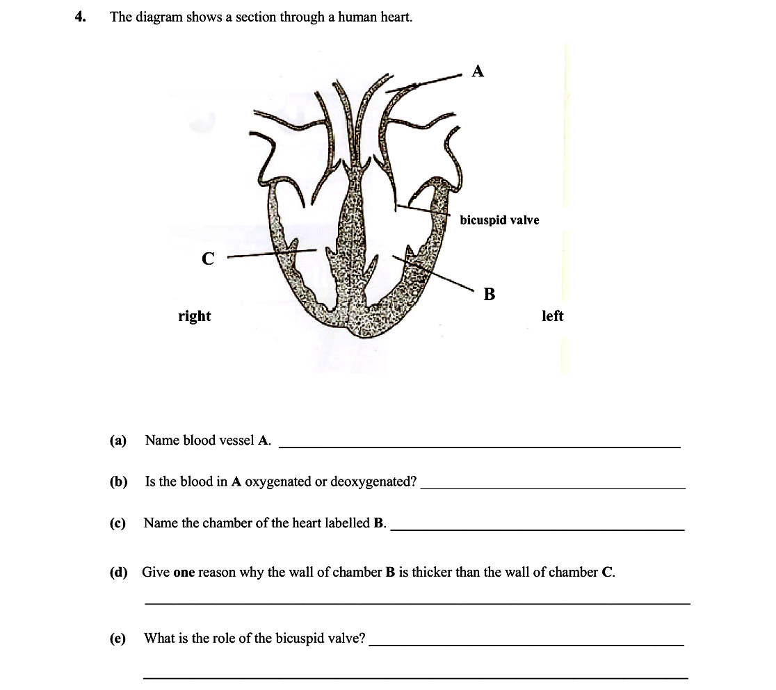 The-diagram-shows-a-section-through-a-human-heart-Leaving Cert Biology-Question 4-2008.png