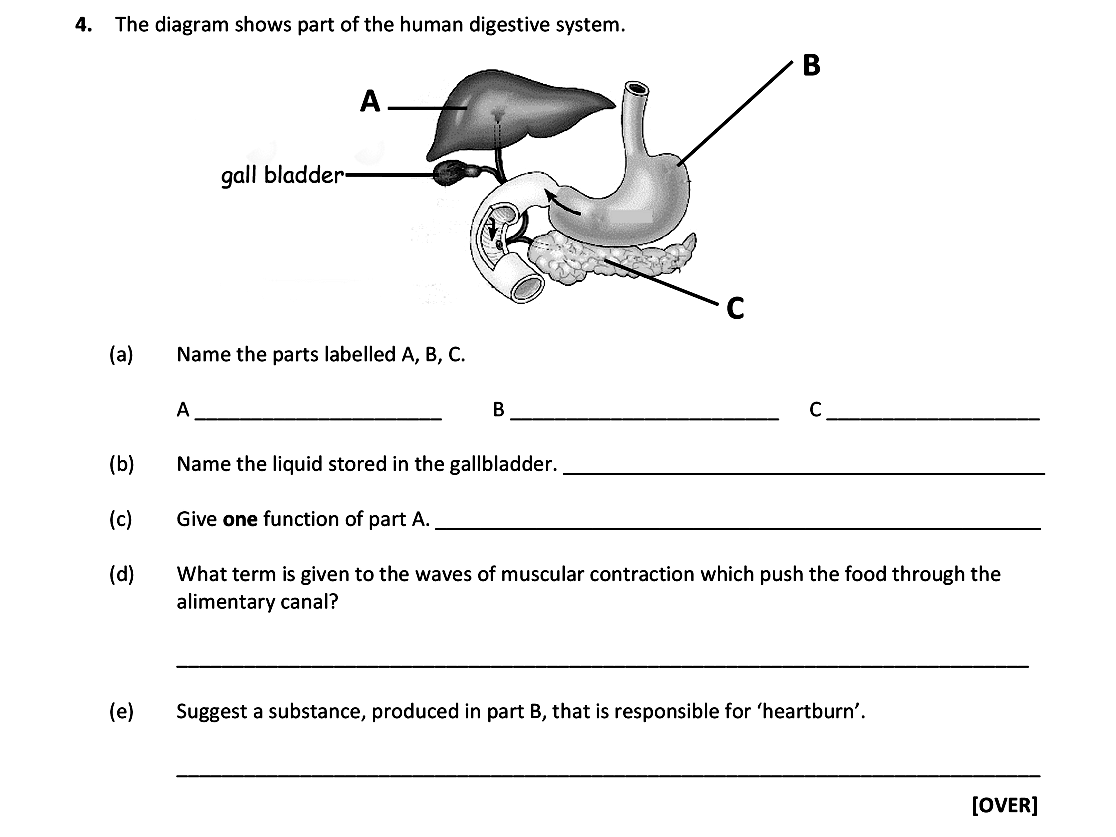 The-diagram-shows-part-of-the-human-digestive-system-Leaving Cert Biology-Question 4-2017.png