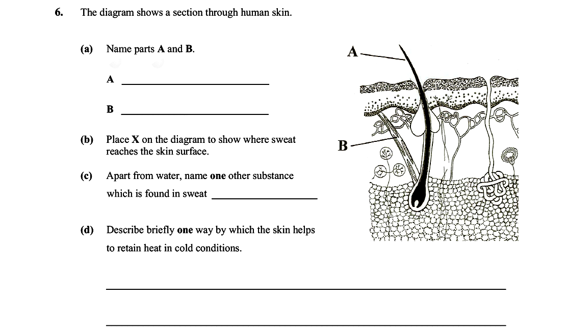 The-diagram-shows-a-section-through-human-skin-Leaving Cert Biology-Question 6-2008.png