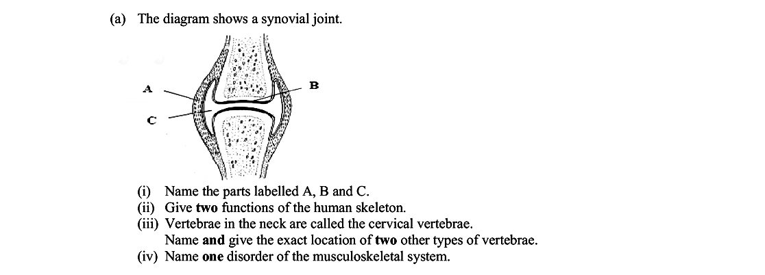 The-diagram-shows-a-synovial-joint-Leaving Cert Biology-Question 14-2013.png