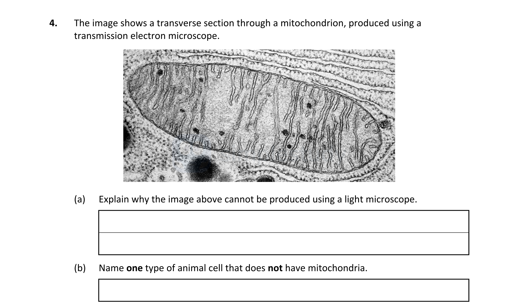 The-image-shows-a-transverse-section-through-a-mitochondrion,-produced-using-a-transmission-electron-microscope-Leaving Cert Biology-Question 4-2022.png