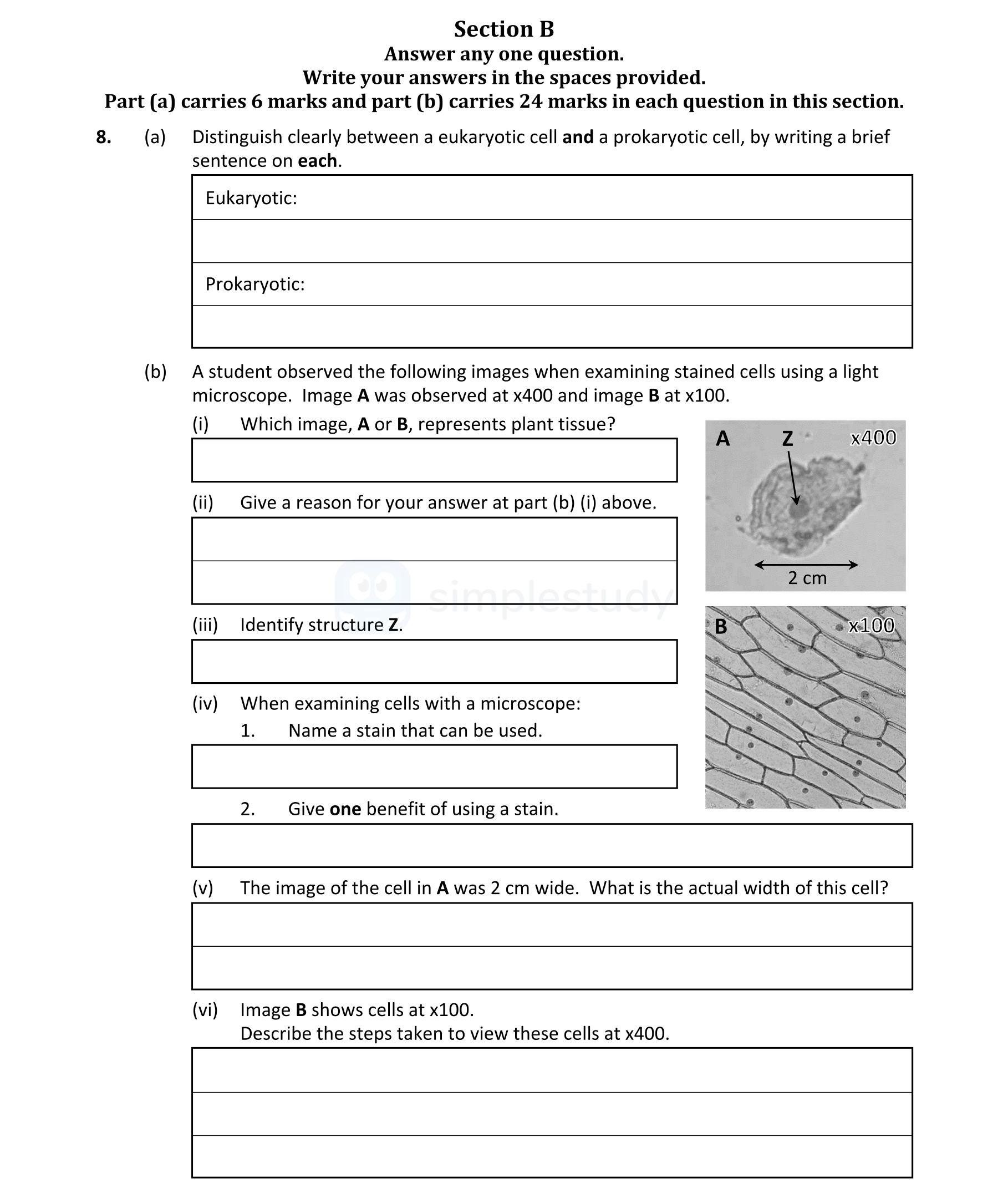 Distinguish-clearly-between-a-eukaryotic-cell-and-a-prokaryotic-cell,-by-writing-a-brief-sentence-on-each-Leaving Cert Biology-Question 8-2022.png