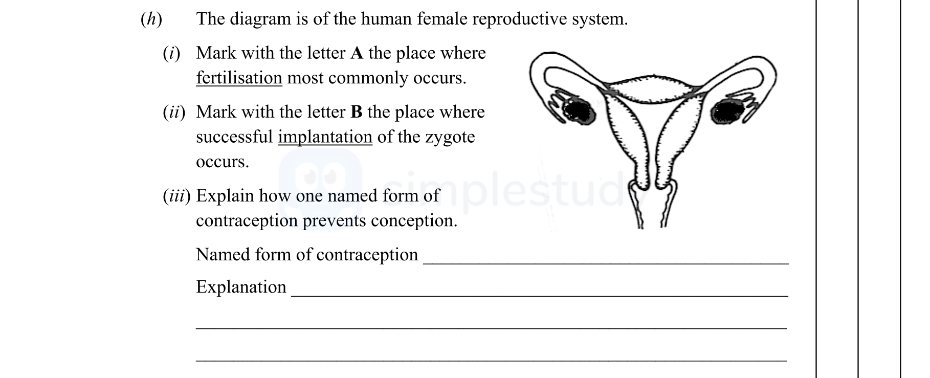 The-diagram-is-of-the-human-female-reproductive-system-Junior Cycle Science-Question h-2014.png