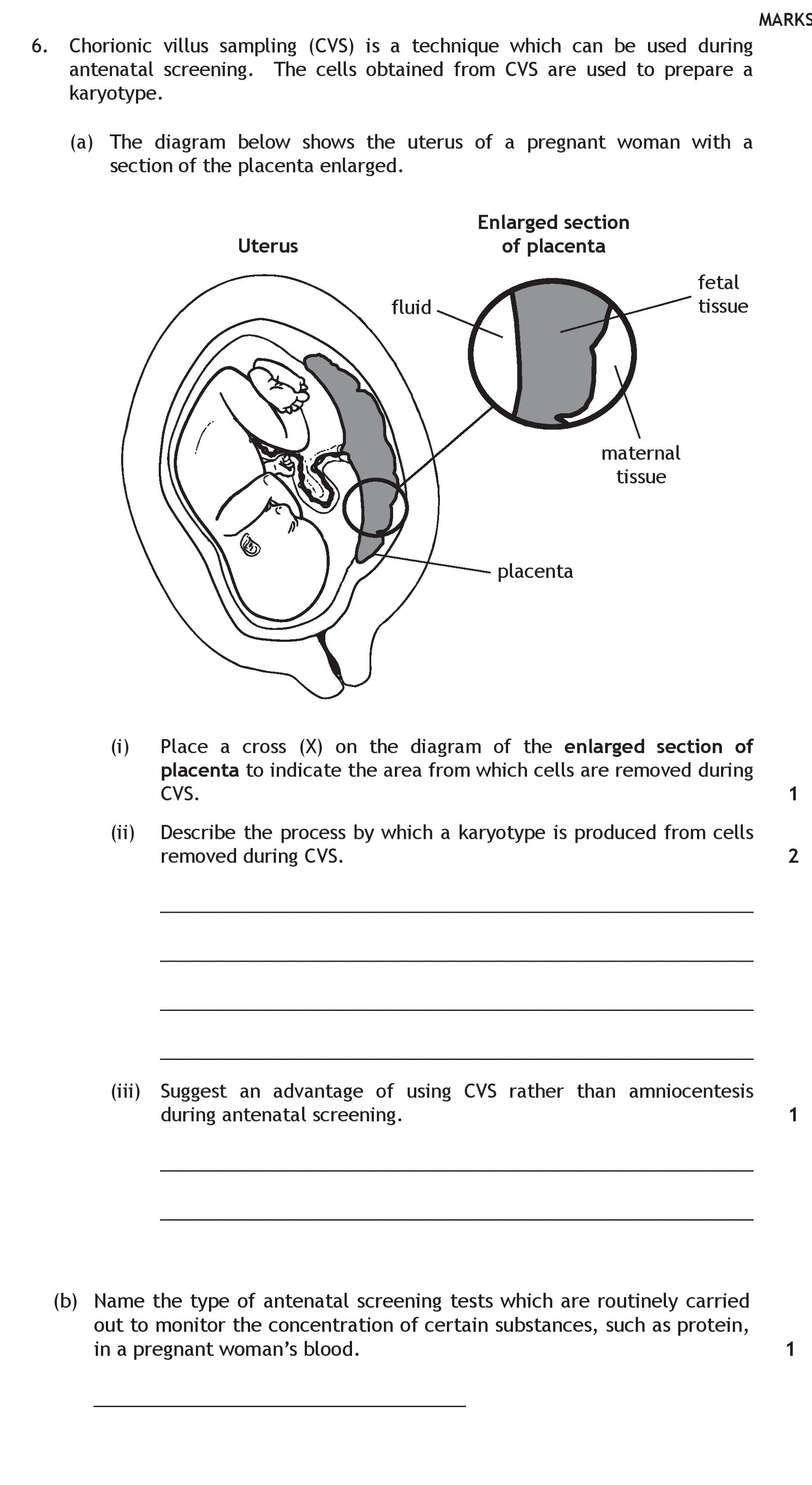 Chorionic-villus-sampling-(CVS)-is-a-technique-which-can-be-used-during-antenatal-screening-Scottish Highers Human Biology-Question 6-2015.png