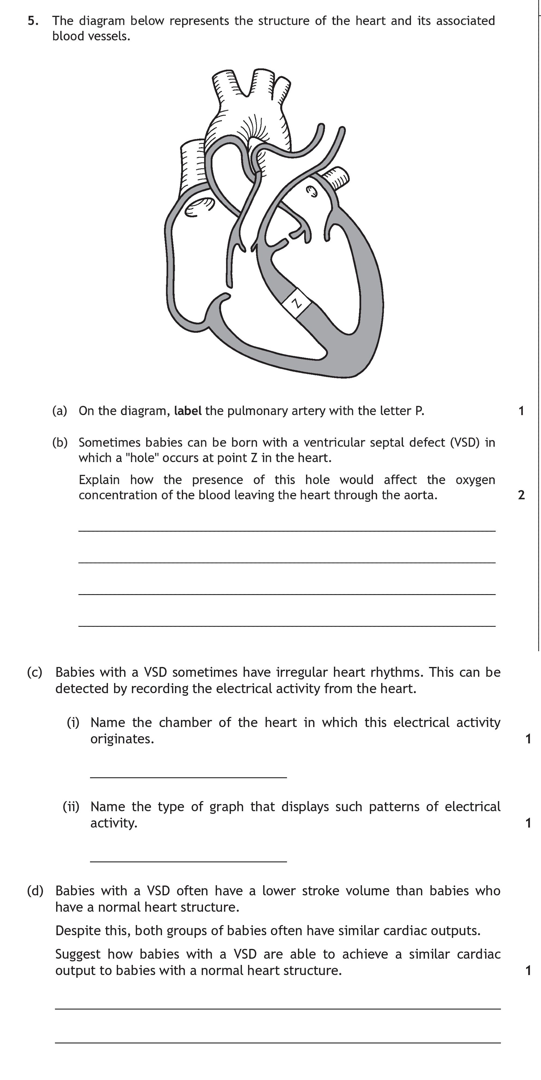 The-diagram-below-represents-the-structure-of-the-heart-and-its-associated-blood-vessels-Scottish Highers Human Biology-Question 5-2016.png