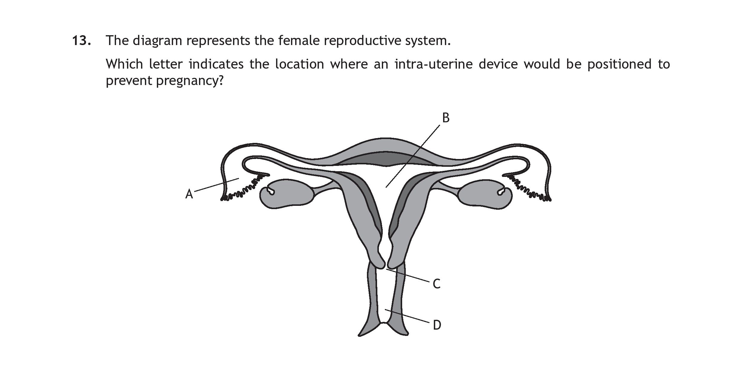 The-diagram-represents-the-female-reproductive-system-Scottish Highers Human Biology-Question 13-2019.png