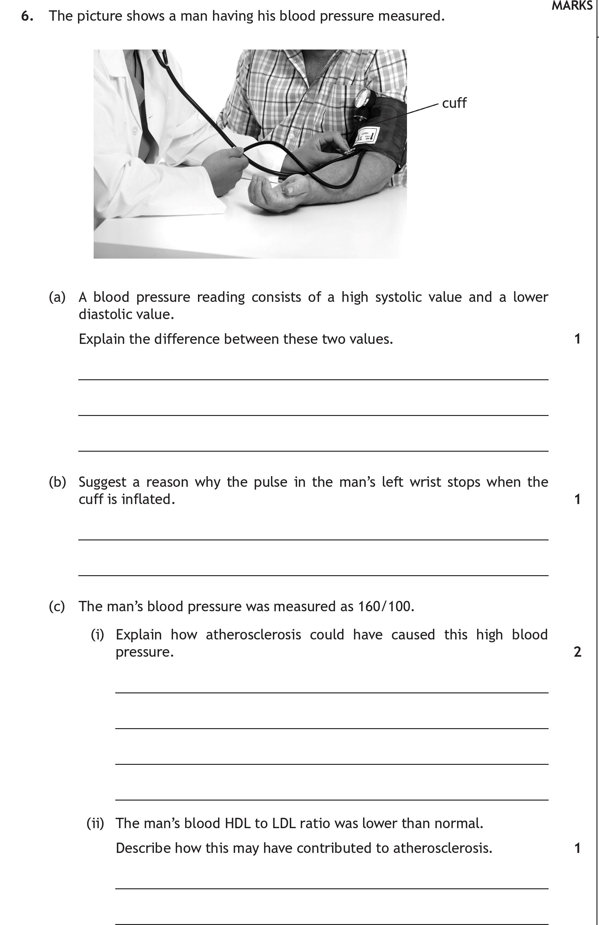 The-picture-shows-a-man-having-his-blood-pressure-measured-Scottish Highers Human Biology-Question 6-2017.png