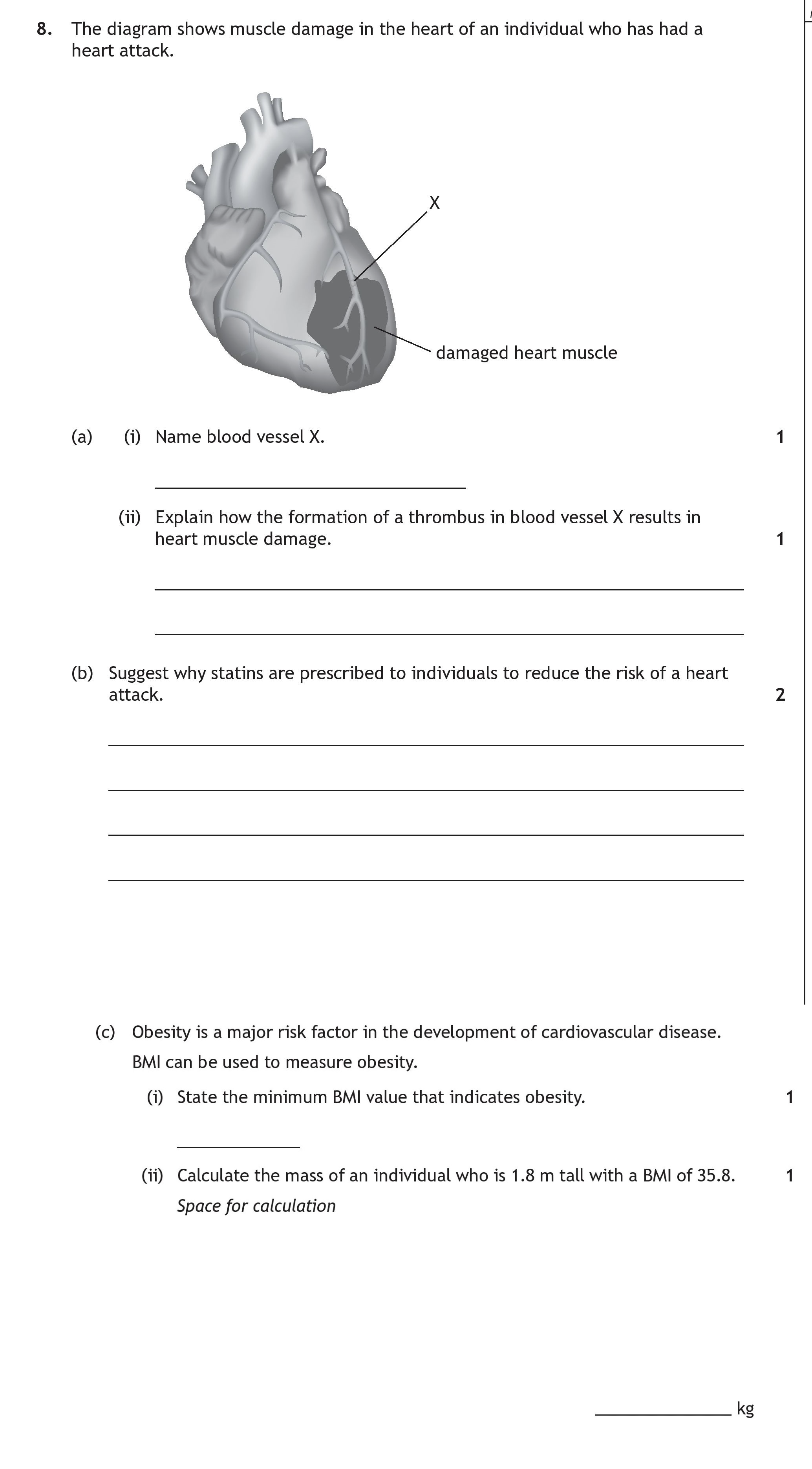 The-diagram-shows-muscle-damage-in-the-heart-of-an-individual-who-has-had-a-heart-attack-Scottish Highers Human Biology-Question 8-2023.png