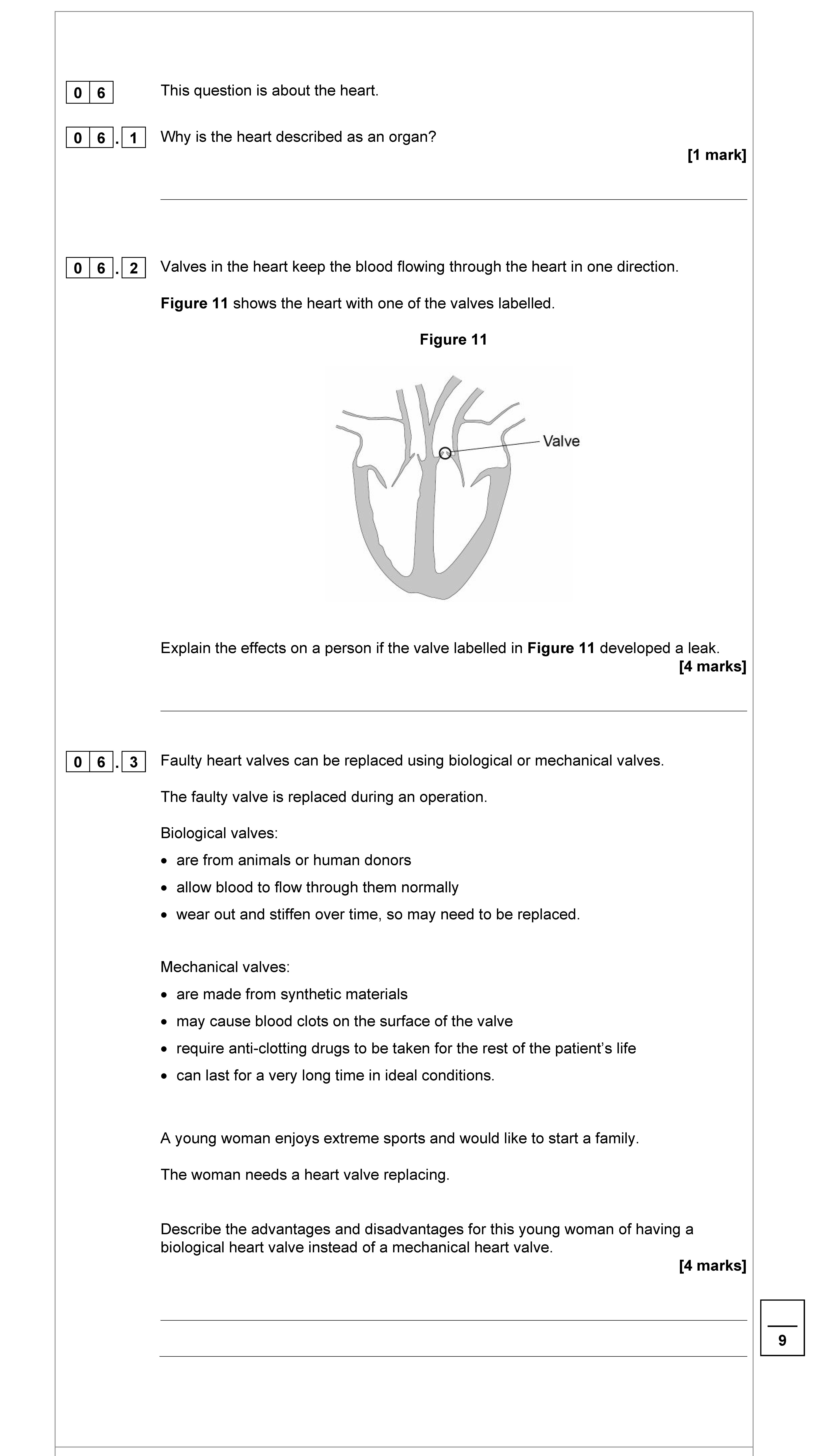 This-question-is-about-the-heart-AQA-GCSE Biology Combined Science-Question 6-2022-Paper 1.png
