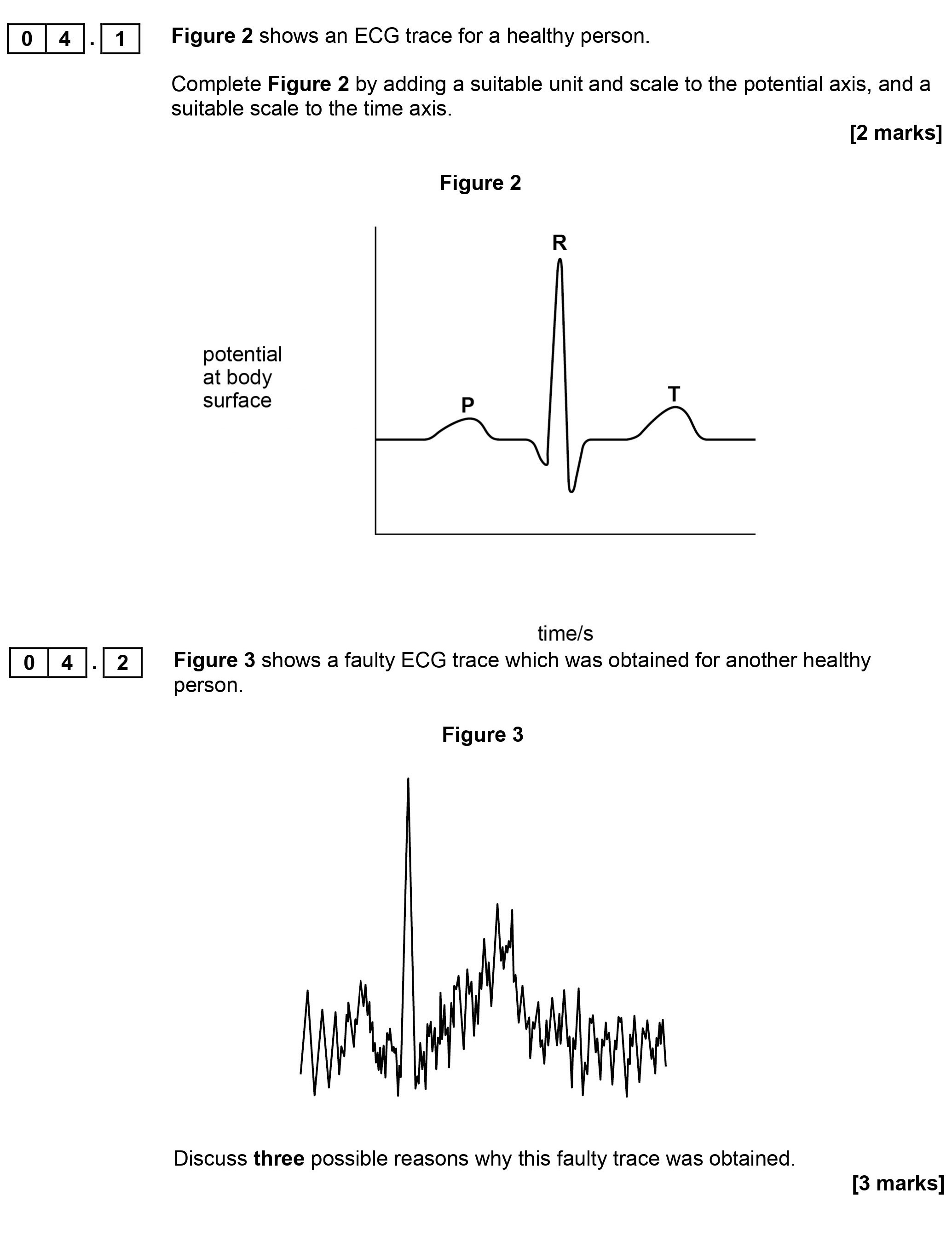 Figure-2-shows-an-ECG-trace-for-a-healthy-person-AQA-A-Level Physics-Question 4-2017-Paper 5.png