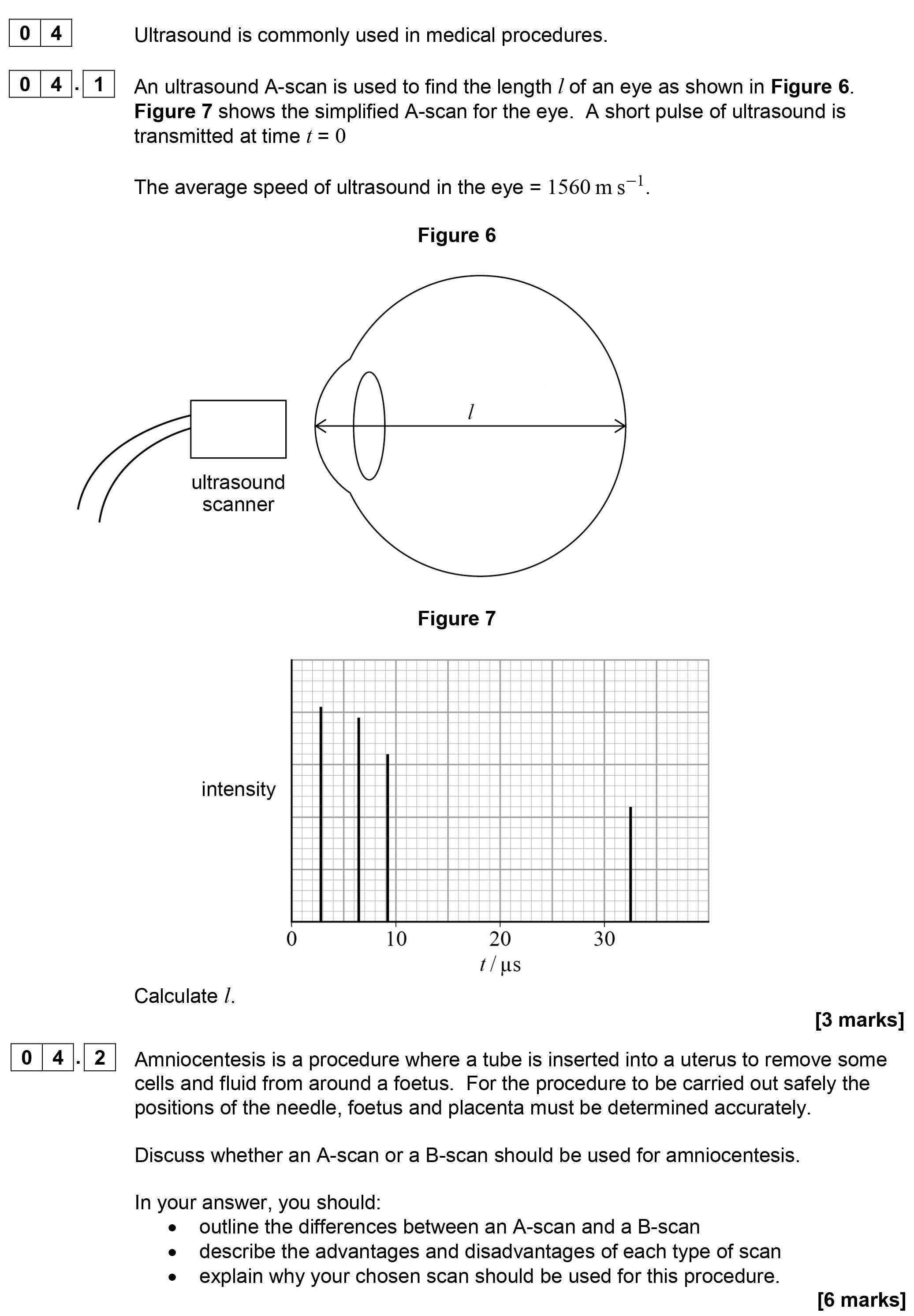 An-ultrasound-A-scan-is-used-to-find-the-length-/-l-of-an-eye-as-shown-in-Figure-6-AQA-A-Level Physics-Question 4-2019-Paper 5.png