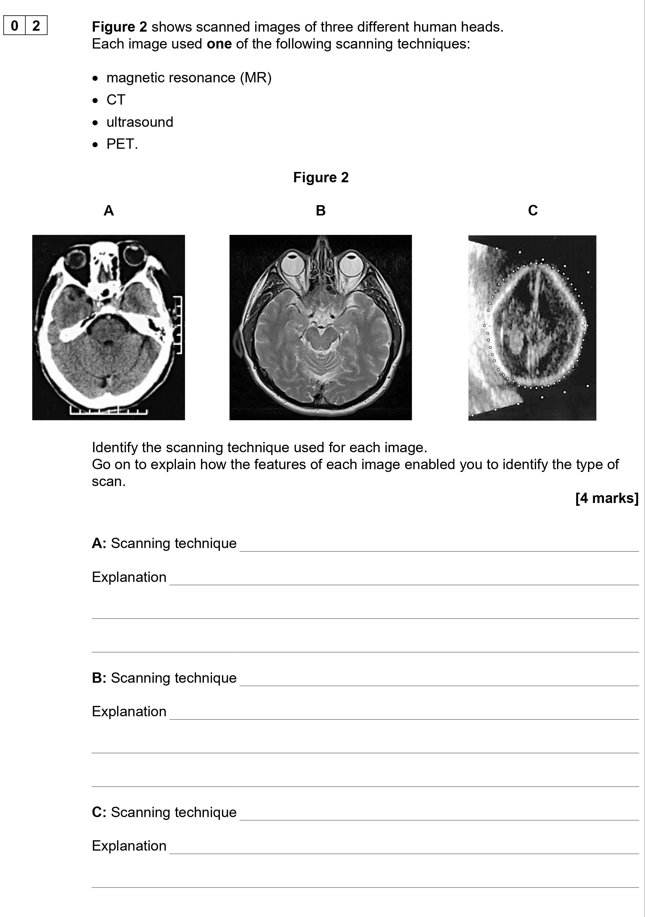 Figure-2-shows-scanned-images-of-three-different-human-heads-AQA-A-Level Physics-Question 2-2021-Paper 5.png